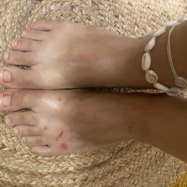 Brees Feet