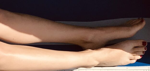 ClarityFeet