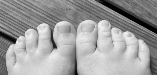 Small Feets